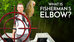 What is Fisherman’s Elbow?